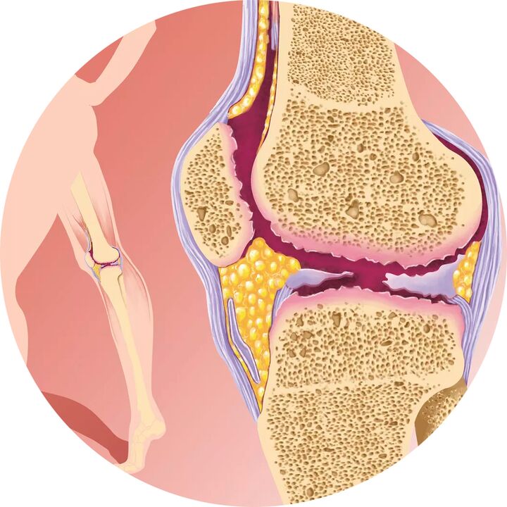 Hondroten – Unterstützt die Beweglichkeit der Gelenke