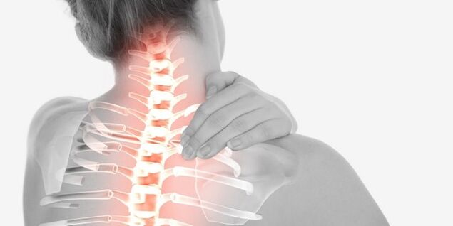 Nackenschmerzen aufgrund von Osteochondrose